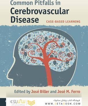 Common Pitfalls in Cerebrovascular Disease: Case-Based Learning