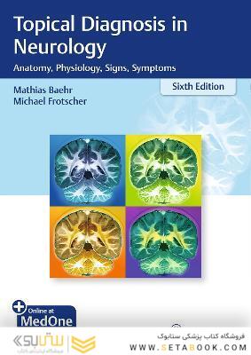 Topical Diagnosis in Neurology: Anatomy, Physiology, Signs, Symptoms
