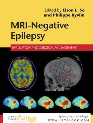 MRI-Negative Epilepsy: Evaluation and Surgical Management