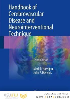 Handbook of Cerebrovascular Disease and Neurointerventional Technique