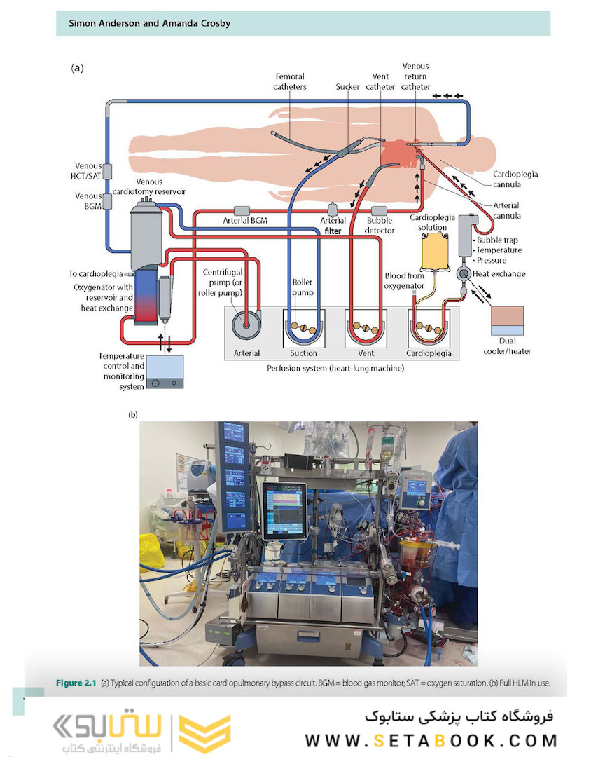 Cardiopulmonary Bypass 3rd Edicion 2022