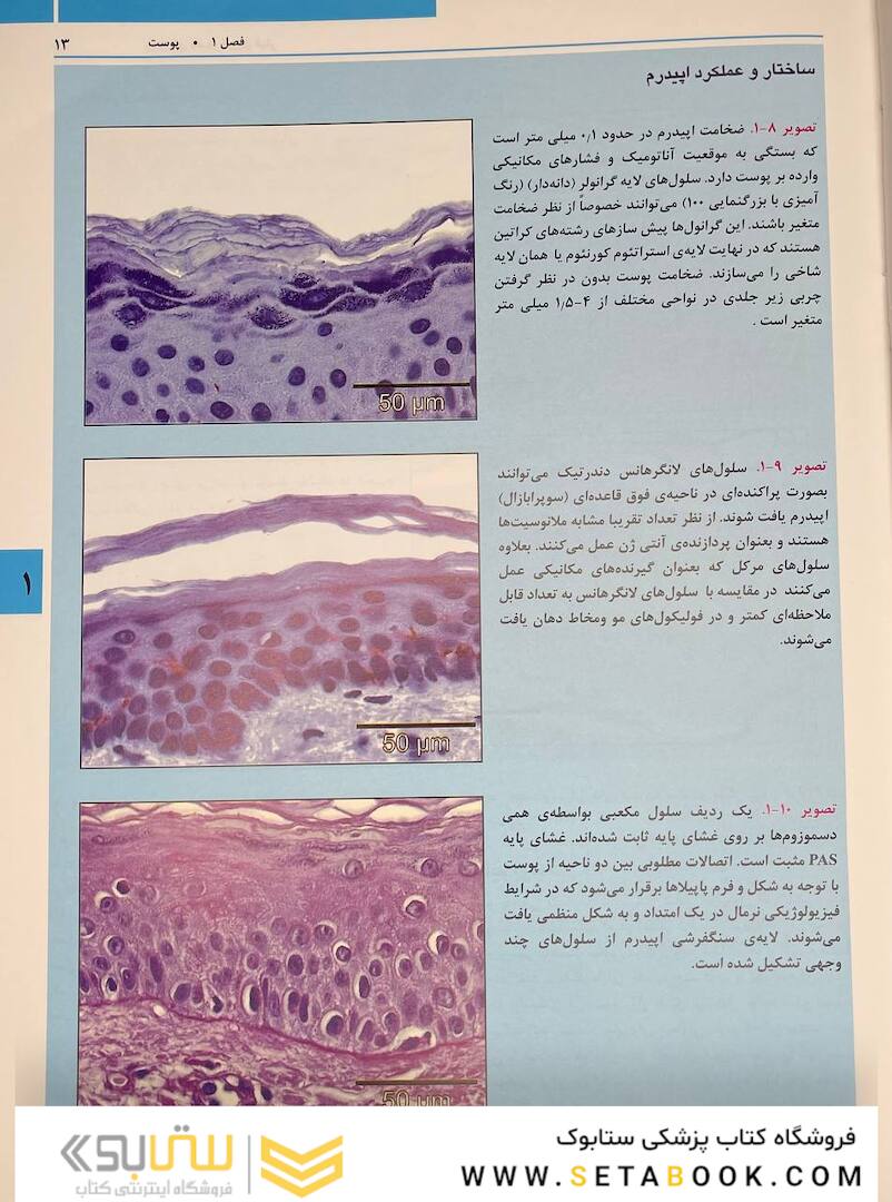 راهنمای مصور تزریق فیلر