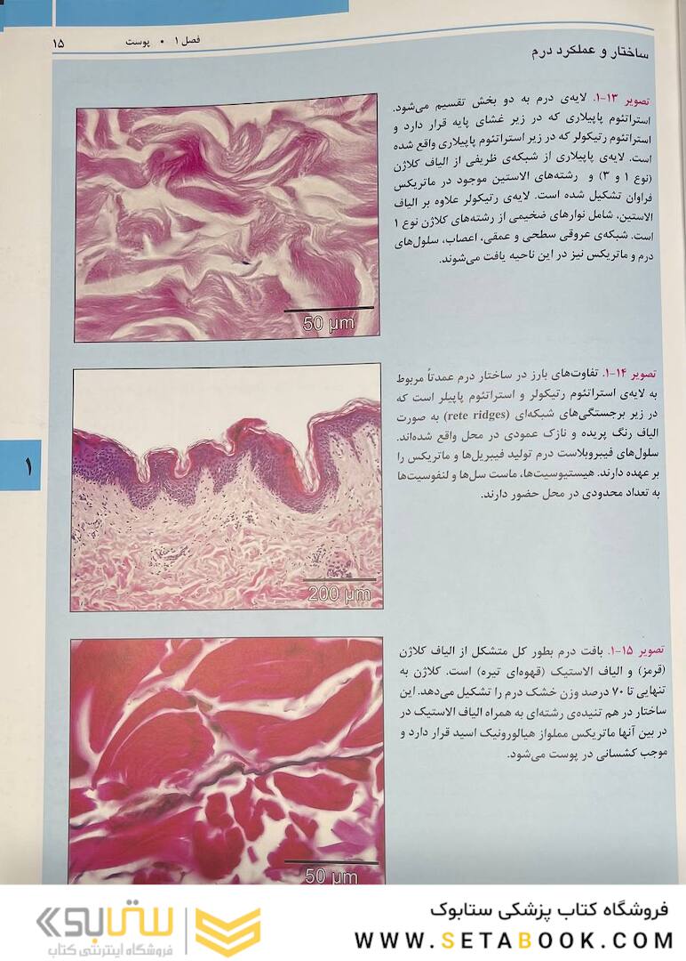 راهنمای مصور تزریق فیلر