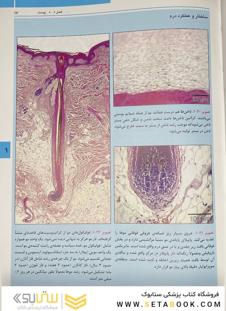 راهنمای مصور تزریق فیلر