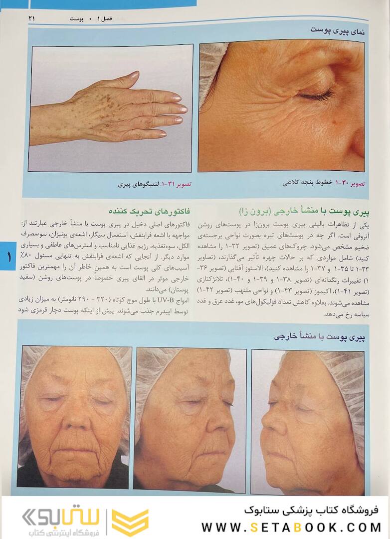 راهنمای مصور تزریق فیلر