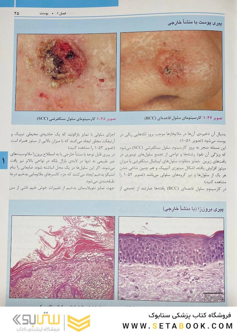 راهنمای مصور تزریق فیلر