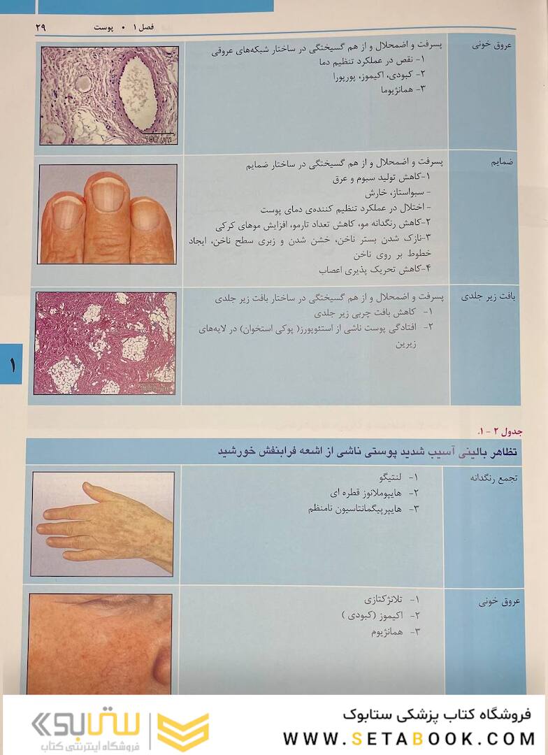 راهنمای مصور تزریق فیلر