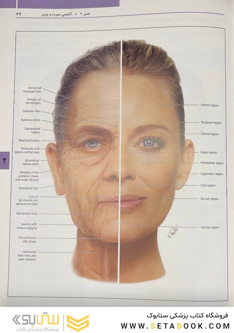 راهنمای مصور تزریق فیلر