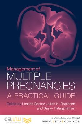 Management of Multiple Pregnancies: A Practical Guide