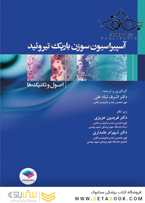 آسپیراسیون سوزن باریک تیروئید اصول و تکنیک ها