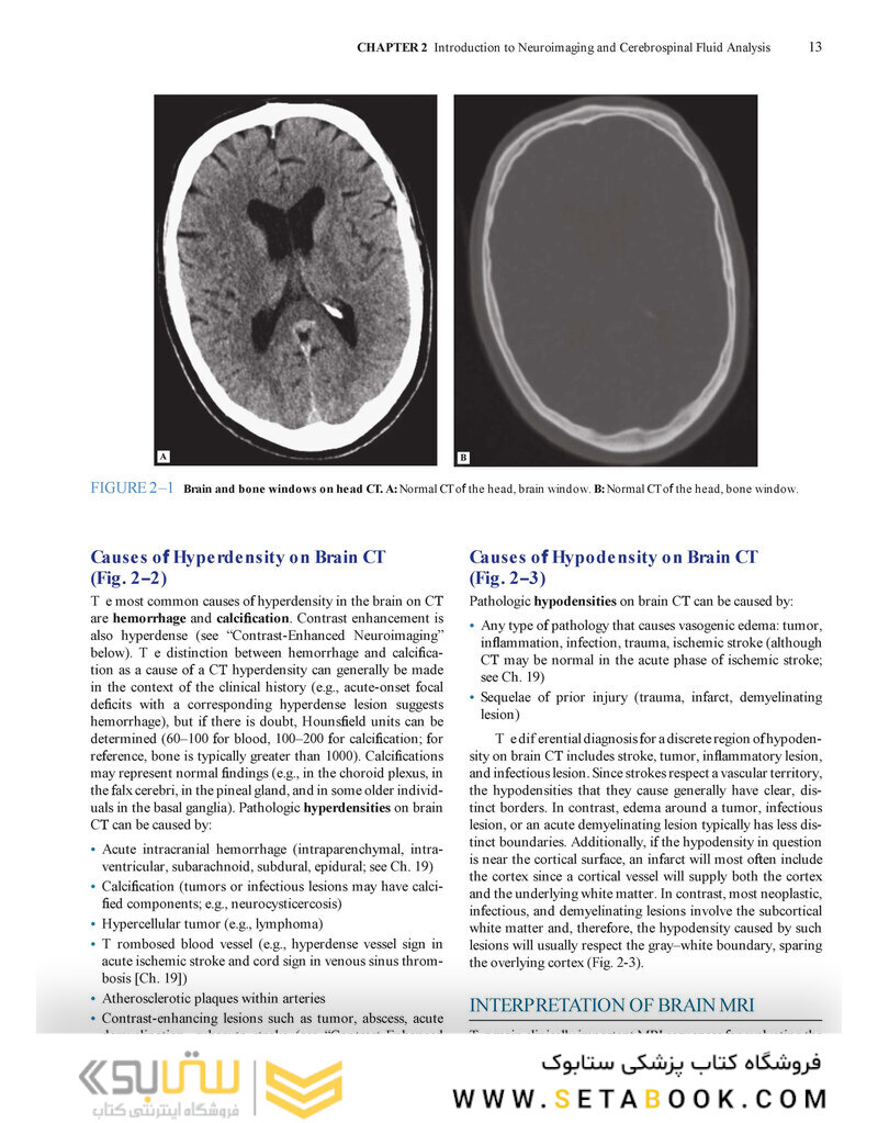 Lange Clinical Neurology and Neuroanatomy: A Localization-Based Approach2017