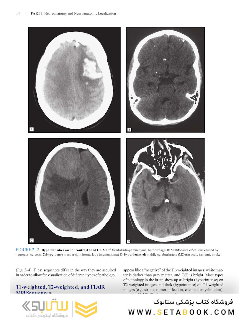 Lange Clinical Neurology and Neuroanatomy: A Localization-Based Approach2017