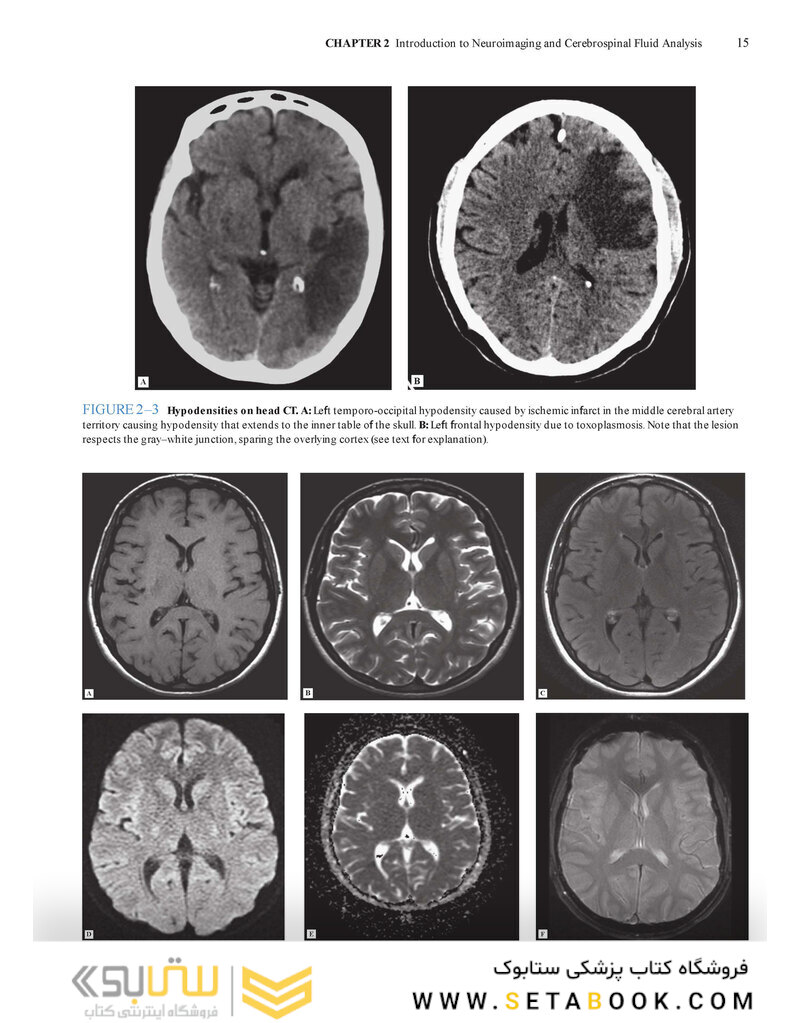 Lange Clinical Neurology and Neuroanatomy: A Localization-Based Approach2017