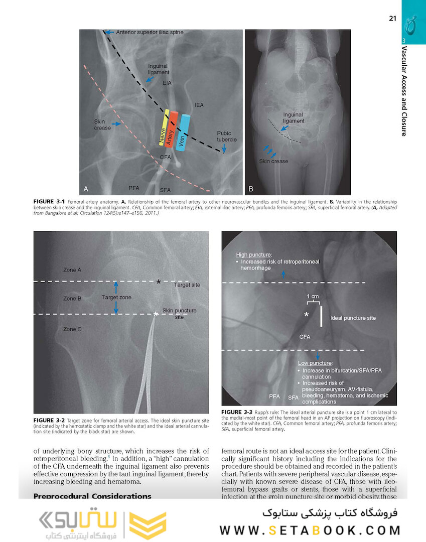 Cardiovascular Intervention, 1st Edition 2015