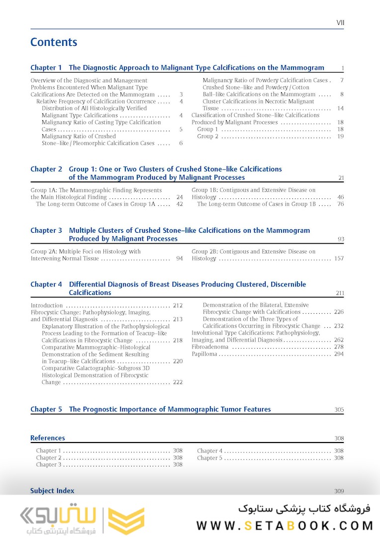 Breast Cancer: Early Detection with Mammography: Crushed Stone-like Calcifications: The Most Frequent Malignant Type 1st Edicion 2008