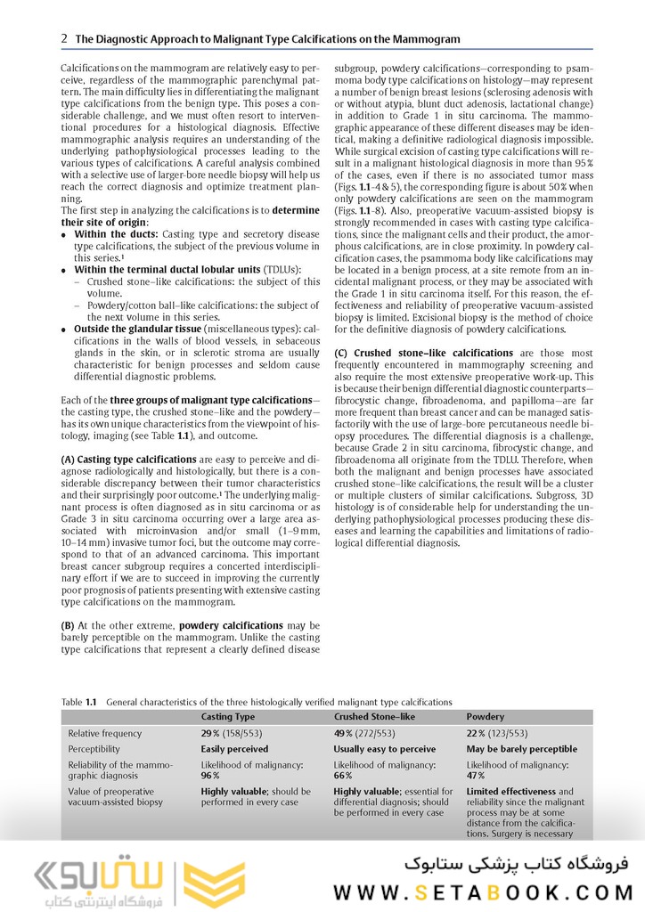 Breast Cancer: Early Detection with Mammography: Crushed Stone-like Calcifications: The Most Frequent Malignant Type 1st Edicion 2008