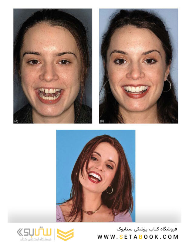 Ronald E. Goldstein’s Esthetics in Dentistry, 3rd Edition2018