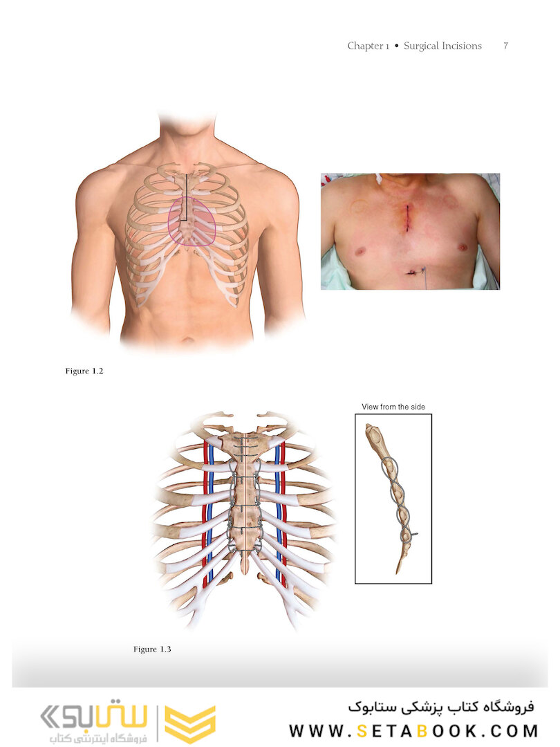 Atlas of Cardiac Surgical Techniques 2nd Edition2018