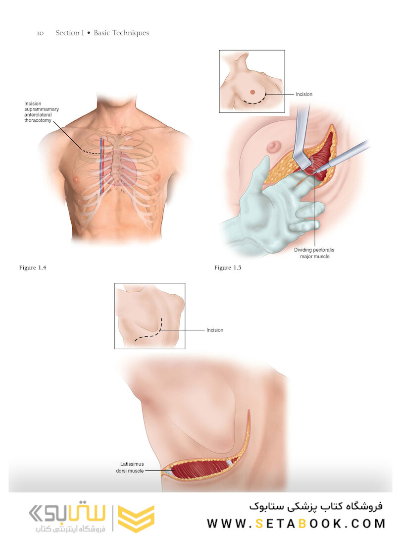 Atlas of Cardiac Surgical Techniques 2nd Edition2018