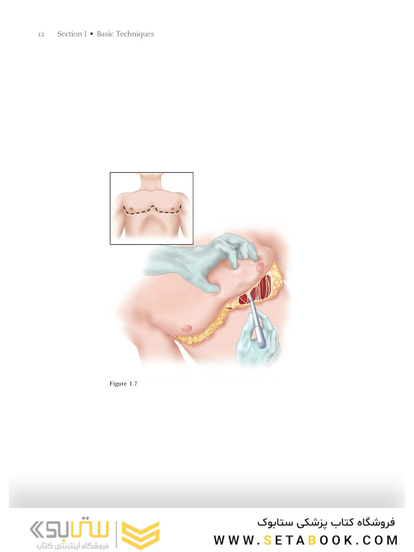 Atlas of Cardiac Surgical Techniques 2nd Edition2018