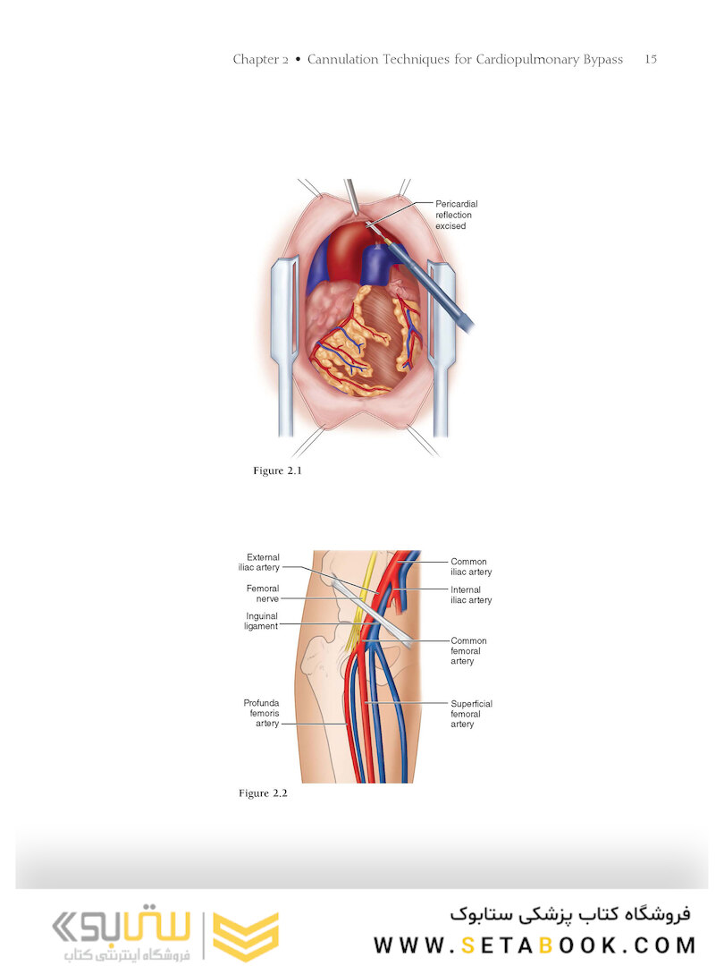 Atlas of Cardiac Surgical Techniques 2nd Edition2018