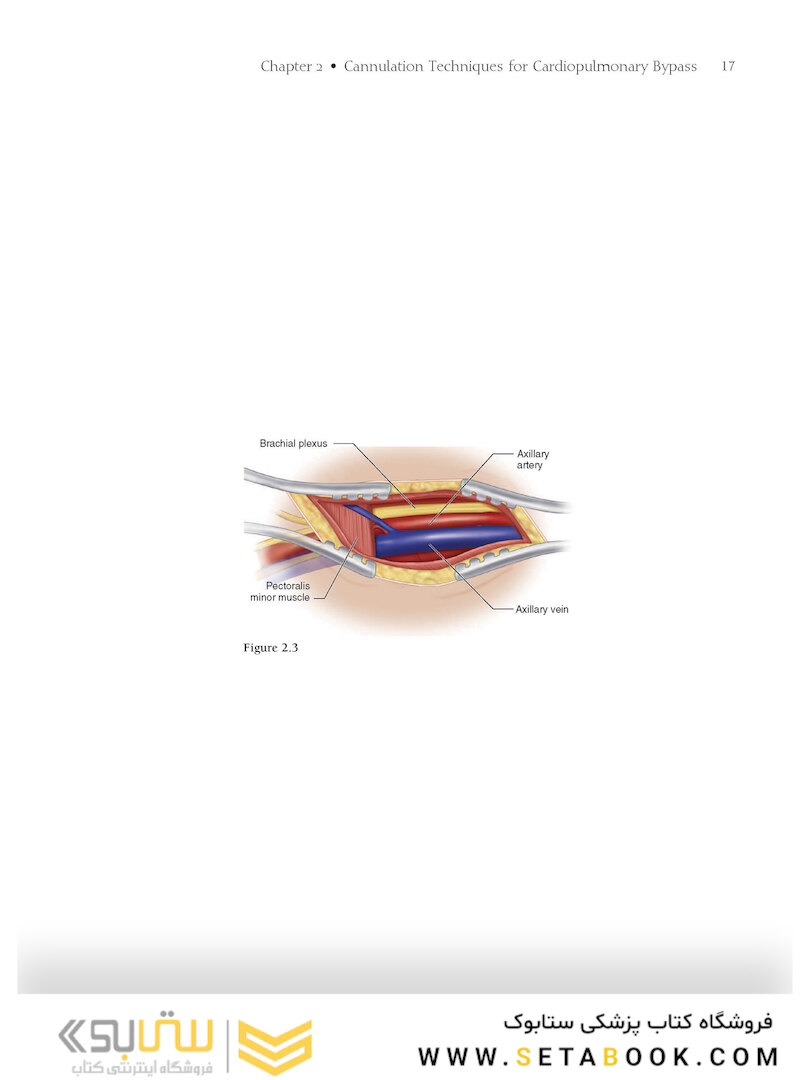 Atlas of Cardiac Surgical Techniques 2nd Edition2018