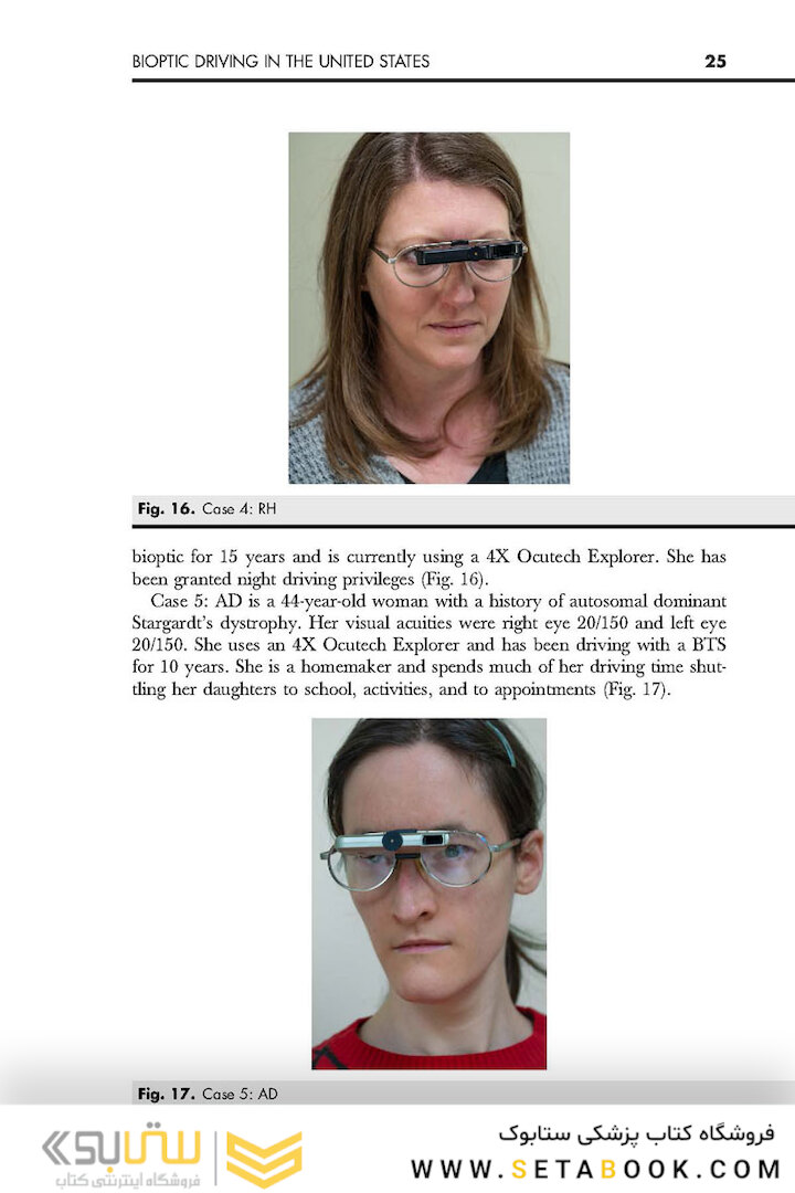 Advances in Ophthalmology and Optometry 1st Edition 2022