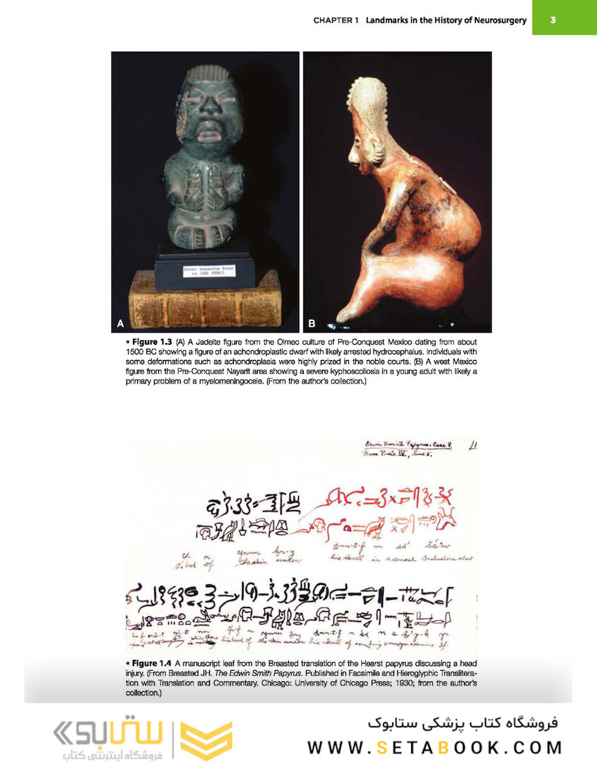 Principles of Neurological Surgery 4th Edition 2018