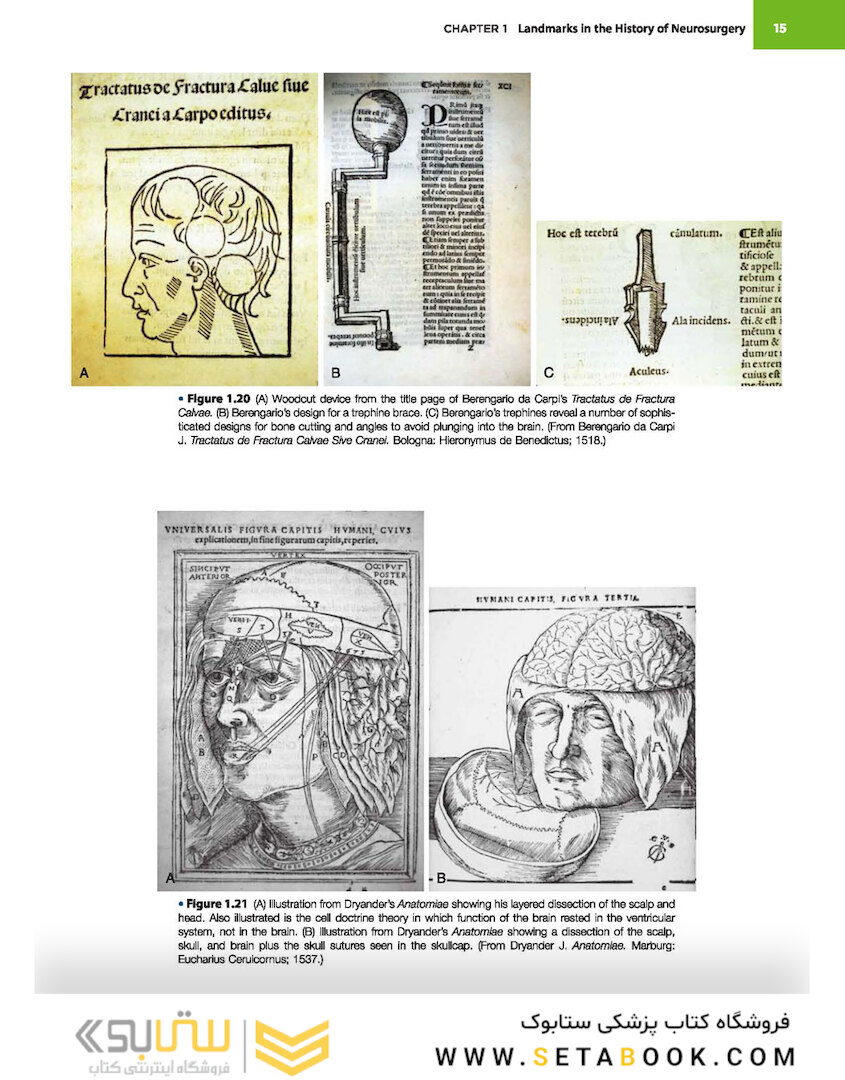 Principles of Neurological Surgery 4th Edition 2018
