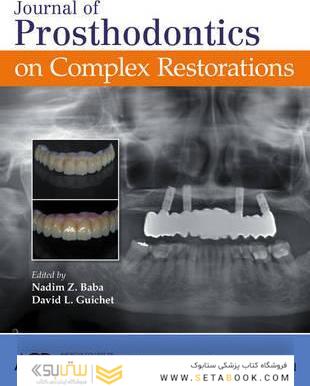 Journal of Prosthodontics on Complex Restorations