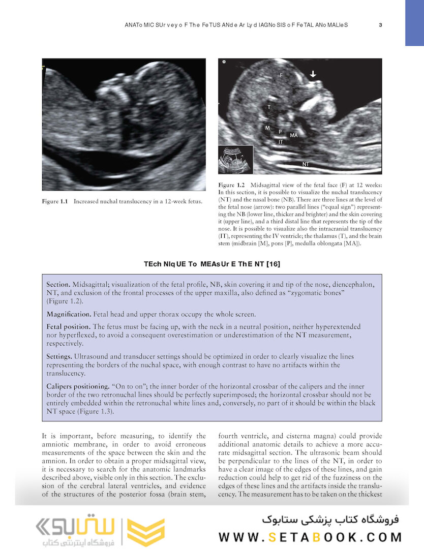Ultrasound of Congenital Fetal Anomalies 2nd Edition2014