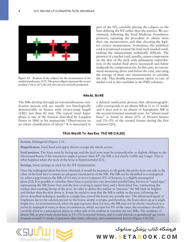Ultrasound of Congenital Fetal Anomalies 2nd Edition2014