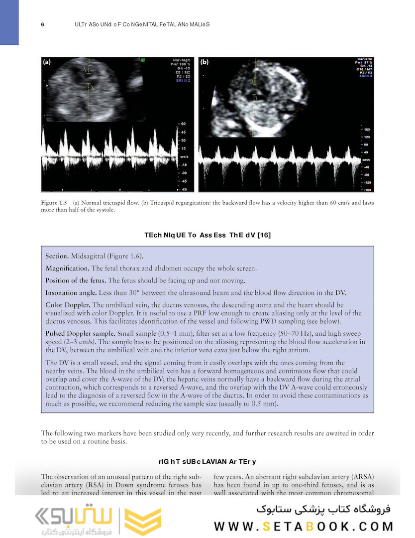Ultrasound of Congenital Fetal Anomalies 2nd Edition2014
