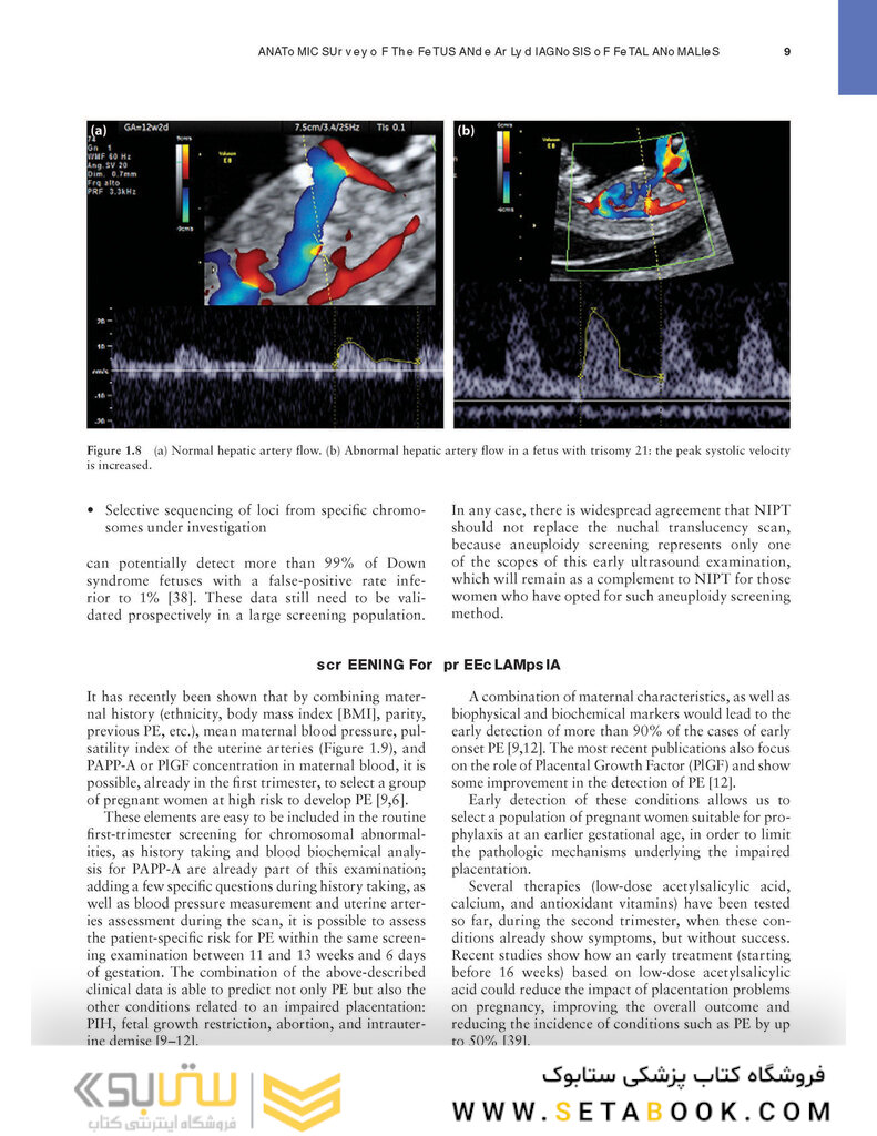 Ultrasound of Congenital Fetal Anomalies 2nd Edition2014