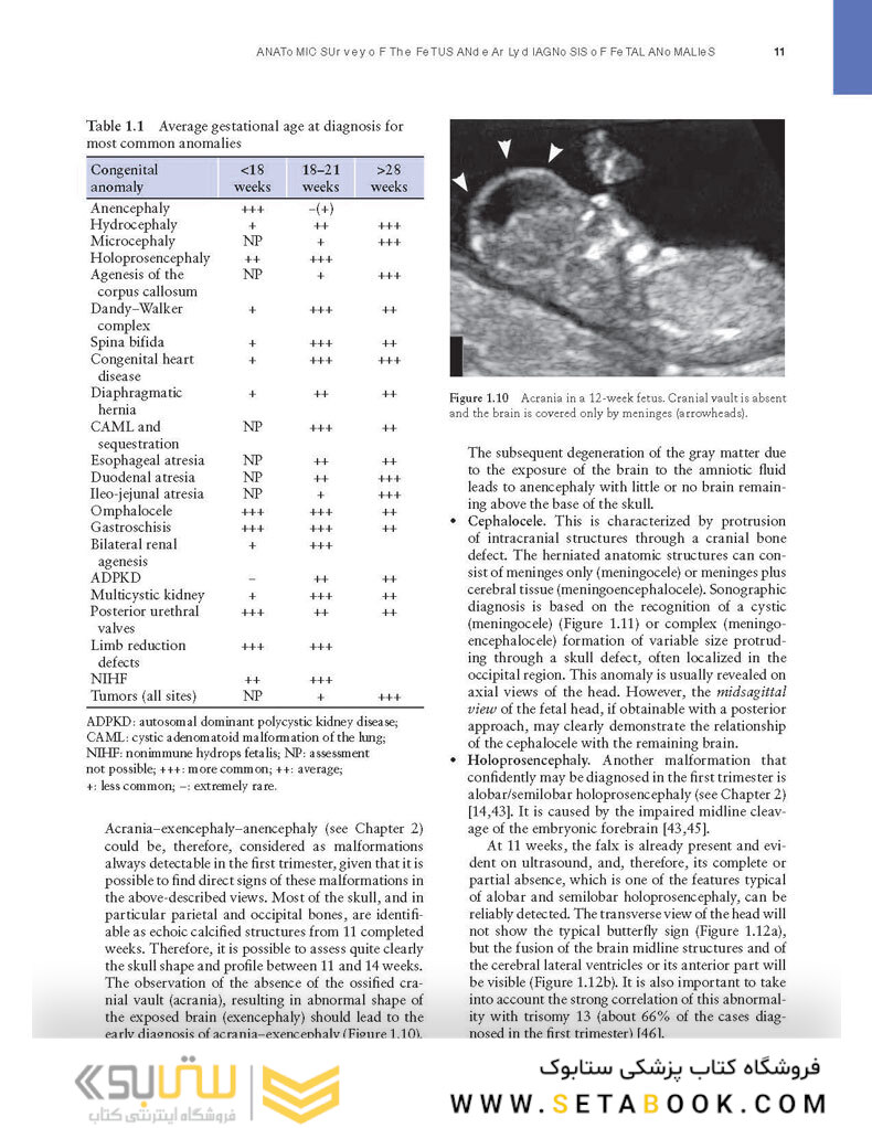 Ultrasound of Congenital Fetal Anomalies 2nd Edition2014