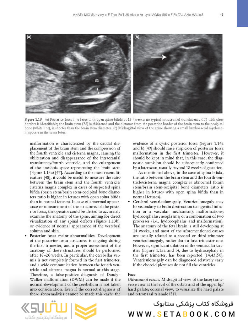 Ultrasound of Congenital Fetal Anomalies 2nd Edition2014