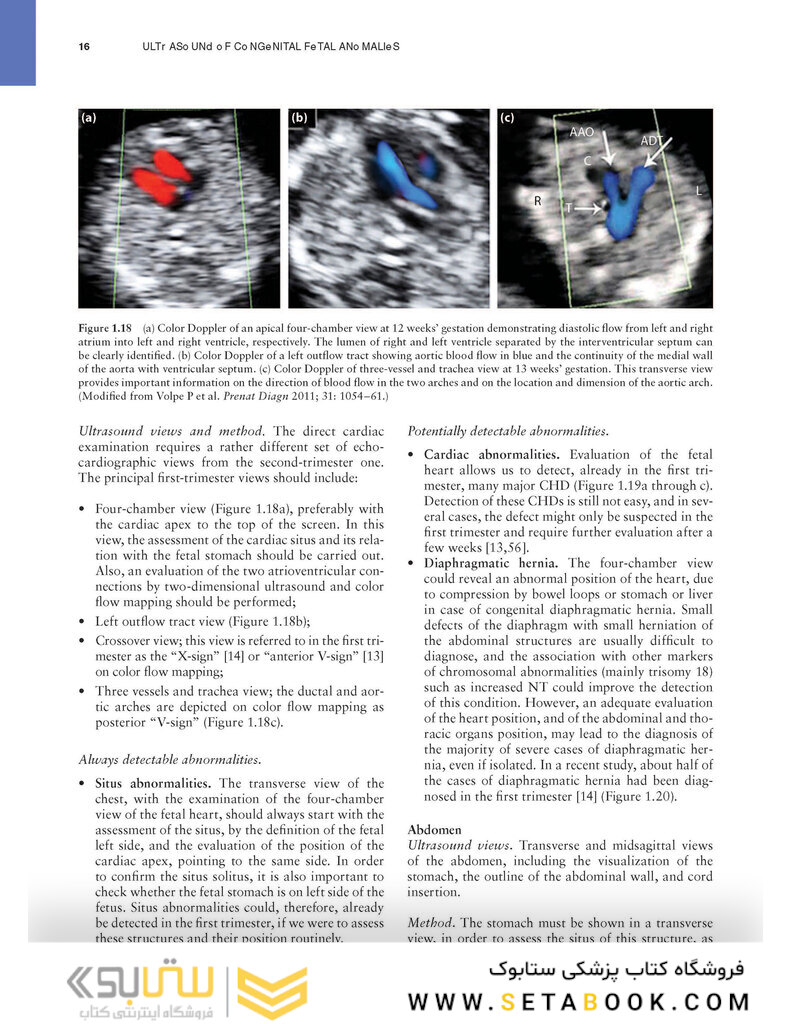 Ultrasound of Congenital Fetal Anomalies 2nd Edition2014