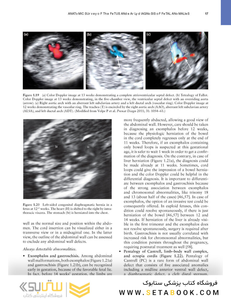 Ultrasound of Congenital Fetal Anomalies 2nd Edition2014