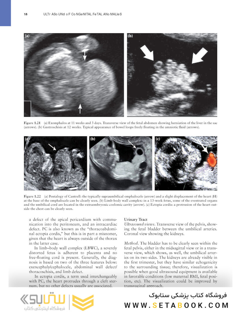 Ultrasound of Congenital Fetal Anomalies 2nd Edition2014