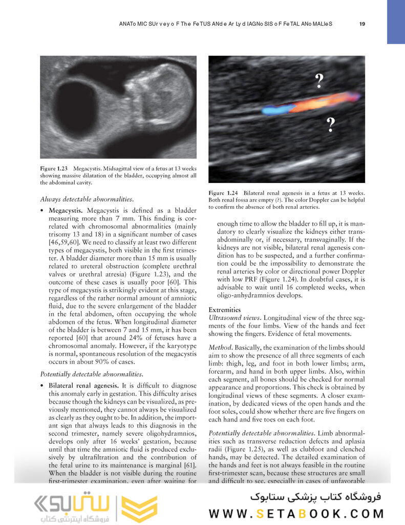 Ultrasound of Congenital Fetal Anomalies 2nd Edition2014