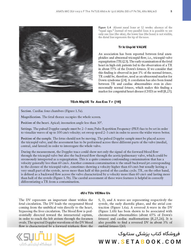 Ultrasound of Congenital Fetal Anomalies 2nd Edition2014
