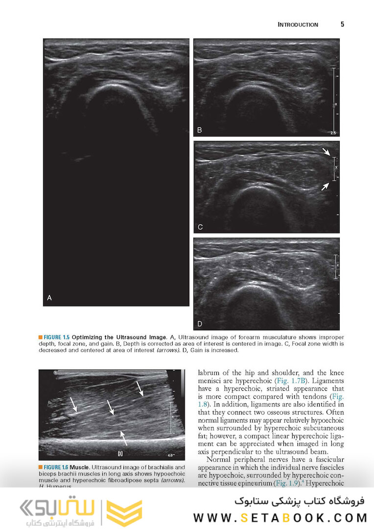 Fundamentals of Musculoskeletal Ultrasound 3rd Edition 2017