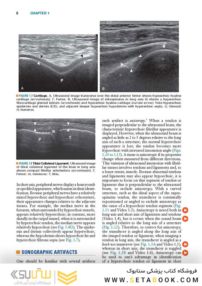 Fundamentals of Musculoskeletal Ultrasound 3rd Edition 2017