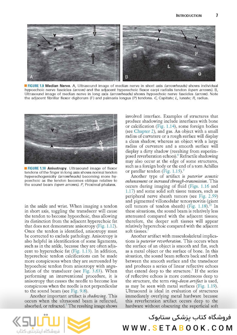 Fundamentals of Musculoskeletal Ultrasound 3rd Edition 2017