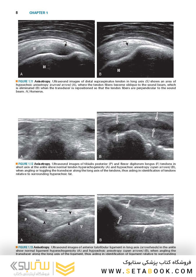 Fundamentals of Musculoskeletal Ultrasound 3rd Edition 2017