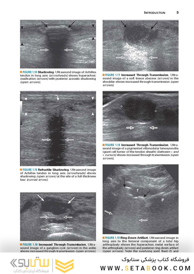 Fundamentals of Musculoskeletal Ultrasound 3rd Edition 2017