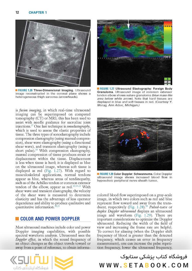 Fundamentals of Musculoskeletal Ultrasound 3rd Edition 2017