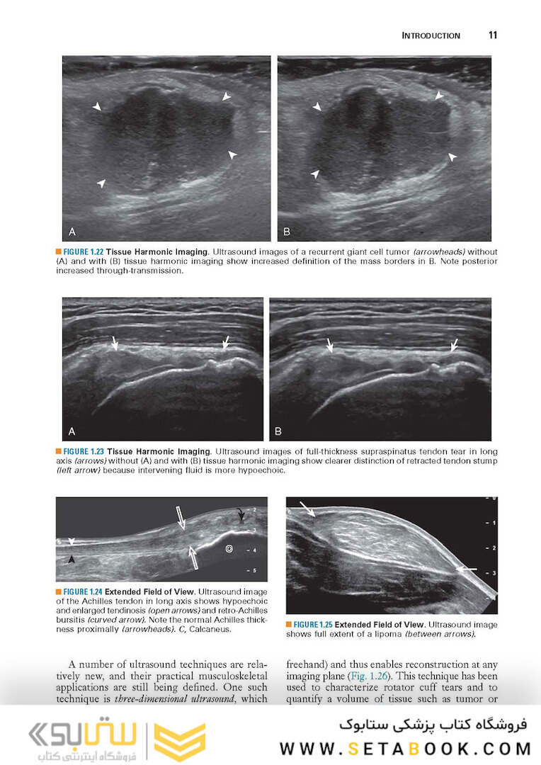 Fundamentals of Musculoskeletal Ultrasound 3rd Edition 2017
