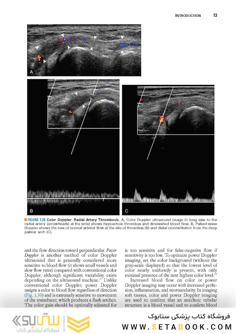 Fundamentals of Musculoskeletal Ultrasound 3rd Edition 2017