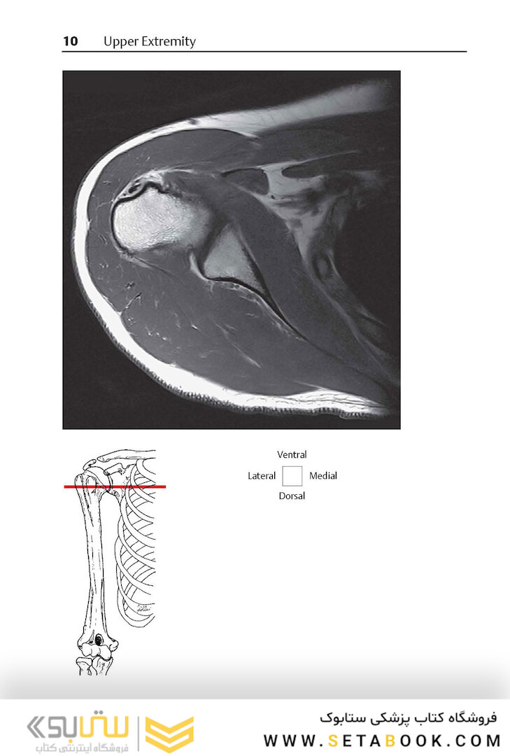 Pocket Atlas of Sectional Anatomy, Volume III, 2nd Edition 2017